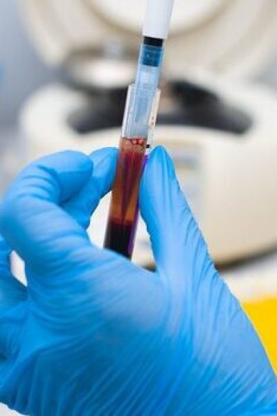 lab-technician-dripping-blood-into-test-tube-from-dispenser_97875-285 lab-technician-dripping-blood-into-test-tube-from-dispenser_97875-285